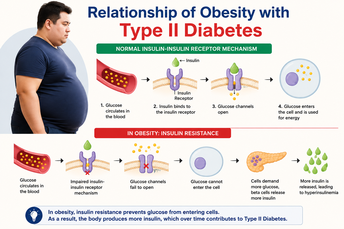 obesity