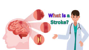 what is a stroke?